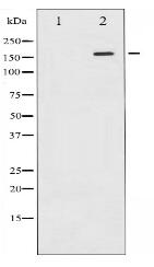 Phospho-EGFR (Tyr1110) Antibody