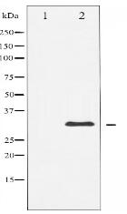 S6 Ribosomal Protein Antibody