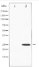 Phospho-eIF4E (Ser209) Antibody