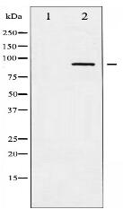 Phospho-ADD1 (Ser726) Antibody