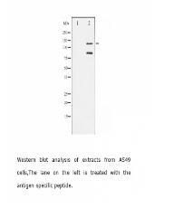 Cleaved-PARP antibody