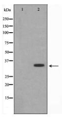 DARPP-32 Antibody