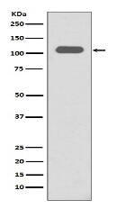 Integrin beta 3 Antibody