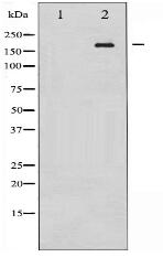 Phospho-EGFR (Tyr1172) Antibody
