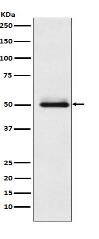 Cytochrome P450 2C9 Antibody