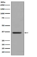 PP2A alpha + beta Antibody