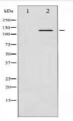 Phospho-Abl (Tyr204) Antibody