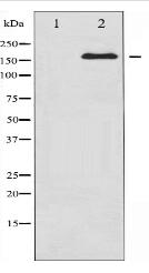 ALK Antibody