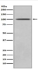 CD10 Antibody