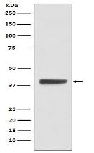 Islet 1 Antibody