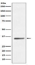 SIRT5 Antibody