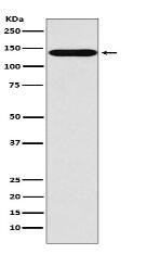 SLC9A1 Antibody