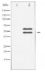 CaMK2-beta/gamma/delta Antibody