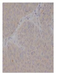 GCET2 Antibody