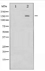 Phospho-EGFR (Ser1026) Antibody