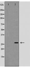 Phospho-Caveolin 2 (Tyr27) Antibody