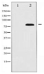 ETK Antibody