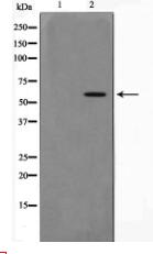 Phospho-AKT1(Thr308) Antibody