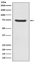 MEKK2 Antibody