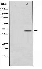 Phospho-c-Jun (Ser73) Antibody