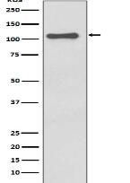 NALP3 Antibody