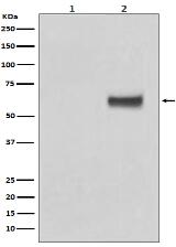 Phospho-ER alpha (S118) Antibody