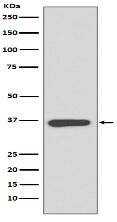 Annexin A10 Antibody