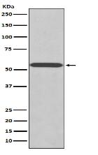 Wilms Tumor Protein Antibody