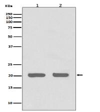 IL1RA Antibody