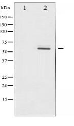 Phospho-Akt2 (Ser474) Antibody