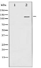 Phospho-FAK (Tyr397) Antibody