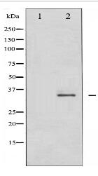 Phospho-CDK2 (Thr160) Antibody
