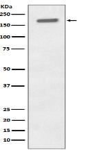 Phospho-EGFR (Y1173) Antibody