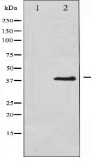 Phospho-eIF2 alpha (Ser51) Antibody