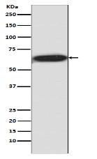 Phospho-S6K1 (T421 + S424) Antibody