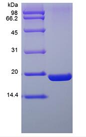 Recombinant Human Ubiquitin-conjugating Enzyme E2 I, His