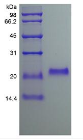 Recombinant Human Osteoprotegerin