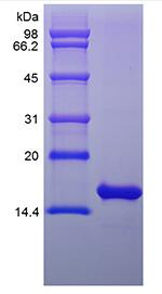 Recombinant Rat Basic Fibroblast Growth Factor