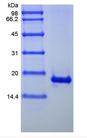 Recombinant Human Interferon-alpha1b