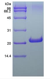 Recombinant Murine Fibroblast Growth Factor 21