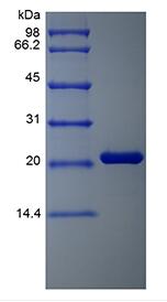 Recombinant Human Oncostatin-M