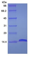 Recombinant Human Fatty-acid-binding Protein 2