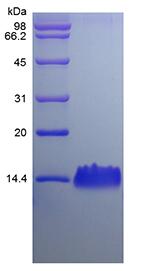 Recombinant Rat LPS-induced CXC Chemokine/CXCL5