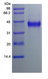 Recombinant Human Cysteine-rich Angiogenic Inducer 61