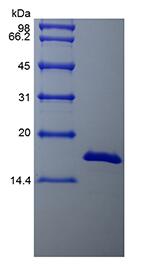 Recombinant Bovine Basic Fibroblast Growth Factor