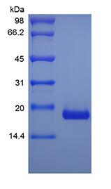 Recombinant Human Interleukin-17B