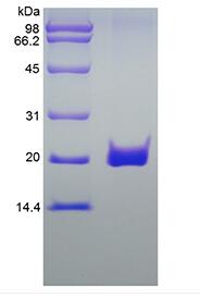Recombinant Human soluble Fas Receptor/TNFRSF6