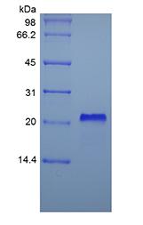 Recombinant Human soluble Tumor Necrosis Factor Receptor Type I/TNFRSF1A