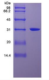 Recombinant Human High Mobility Group Box-1 Protein, His