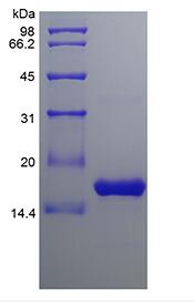 Recombinant Human B cell Activating Factor/TNFSF13B